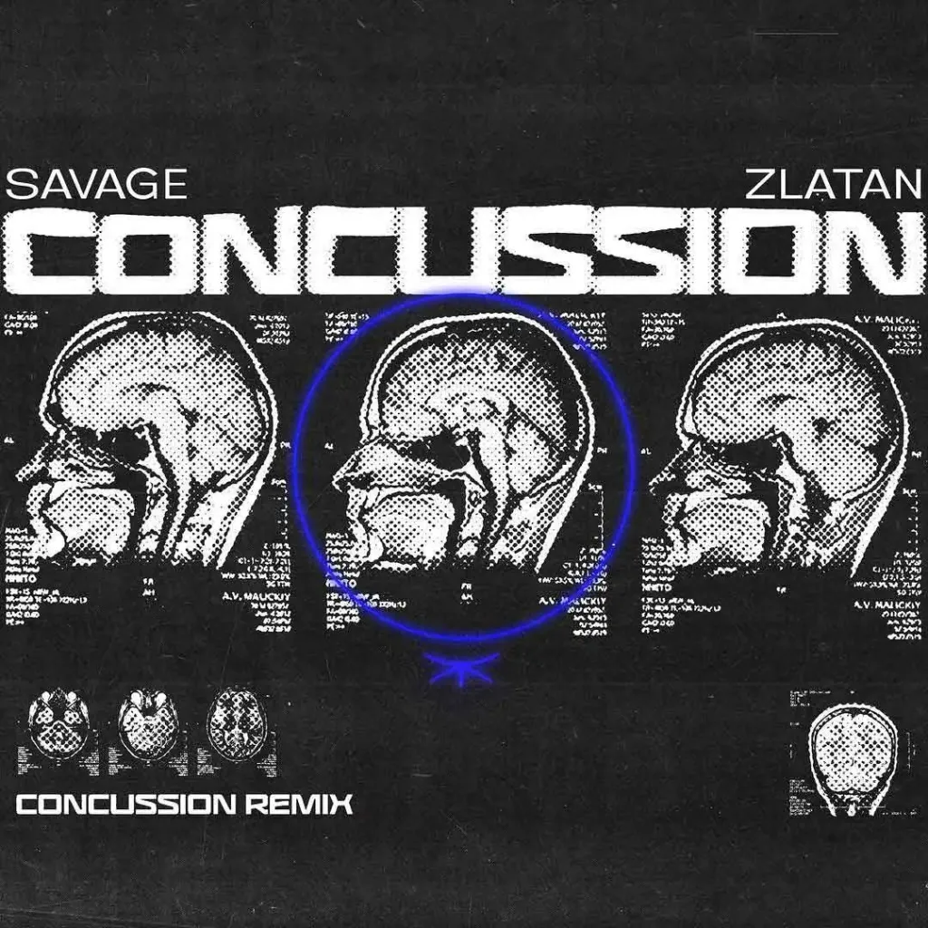 Savage – Concussion (Remix) Ft. Zlatan
